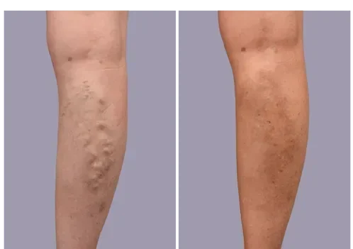 Before and after