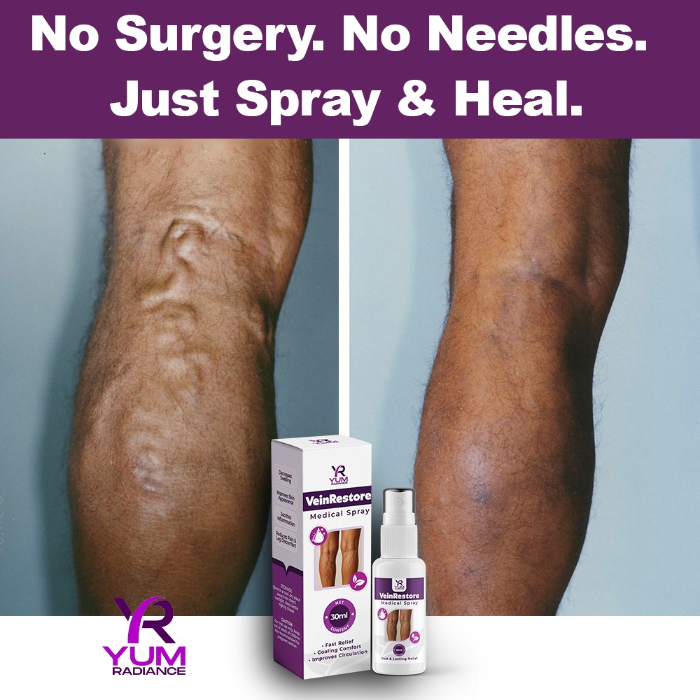 Vein restoration result
